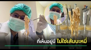 พยาธิตัวตืด