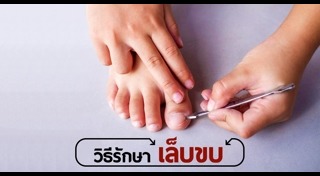 สุขภาพเล็บ
