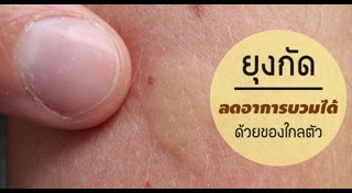 วิธีป้องกันยุงกัด