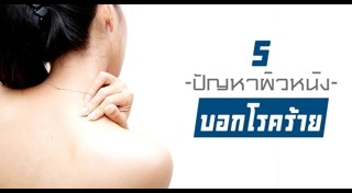 ผิวหนังอักเสบ