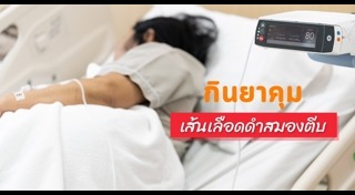 เส้นเลือดสมองแตก