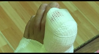 ตัดเล็บ