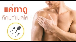 คุมกำเนิด