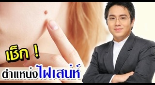 ไฝบนหน้า