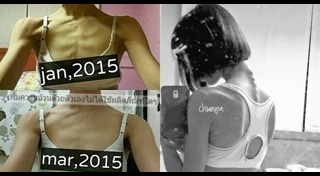 สาวคลั่งผอม