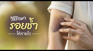 รอยแผลเป็น