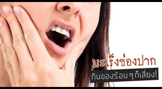 มะเร็งช่องปาก