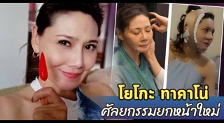 โยโกะ ทาคาโน่