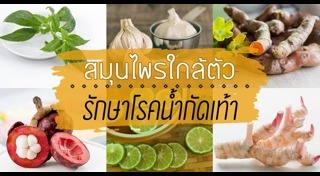 น้ำกัดเท้า