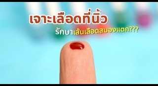 เจาะเลือด
