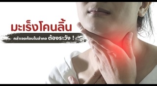 มะเร็งช่องปาก