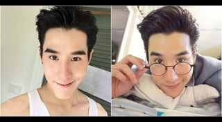 เสริมคาง