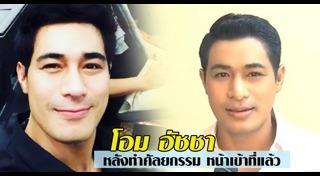 ดาราชายศัลยกรรม