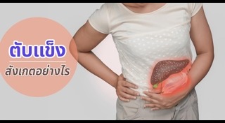 ไวรัสตับอักเสบ