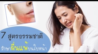 ผิวแพ้ง่าย