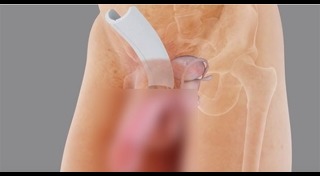 วิธีเพิ่มขนาดอวัยวะเพศชาย