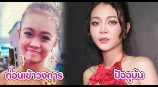 นักร้องลูกทุ่งศัลยกรรม