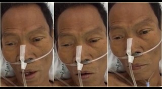 ดอน จมูกบาน