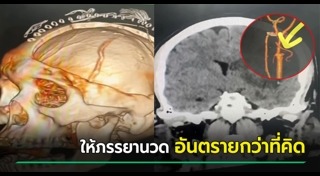 นวด