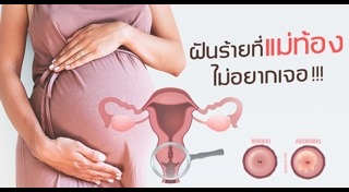 มะเร็งปากมดลูก