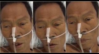 ดอน จมูกบาน