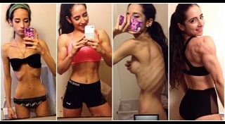 สาวคลั่งผอม