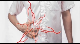 ไส้เลื่อน