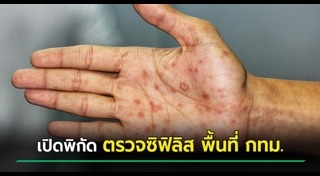 โรคติดต่อทางเพศสัมพันธ์