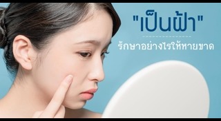 ครีมทาฝ้า