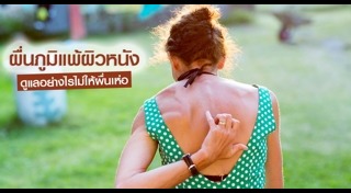 ผิวหนังอักเสบ