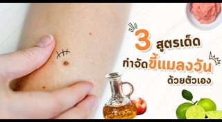 ขี้แมลงวัน