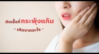 ร้อนใน