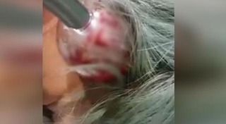 แพทย์แผนไทย