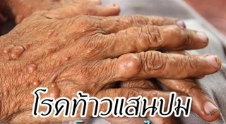 โรคทางพันธุกรรม