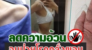 สาวคลั่งผอม