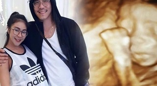 แอนดี้ เขมพิมุก