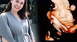 ดาราเกาหลีท้อง